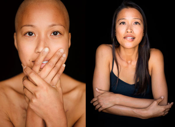Photograph Robert Houser Facing Chemo Before And After on One Eyeland