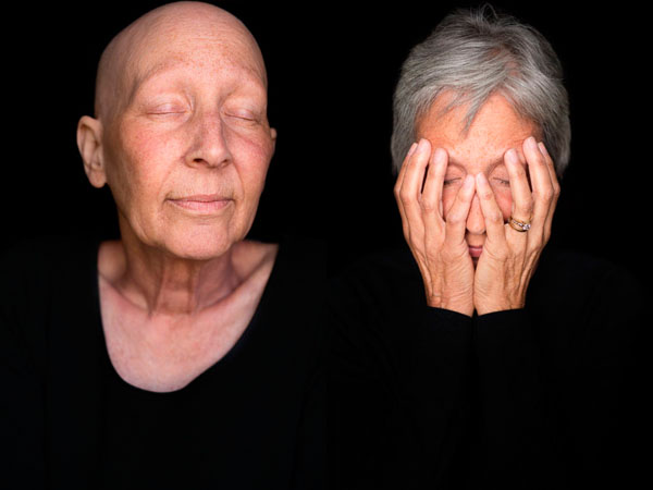 Photograph Robert Houser Facing Chemo Before And After Ferne on One Eyeland