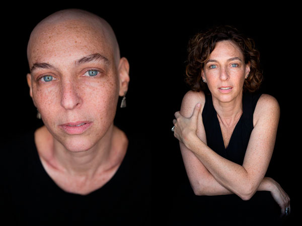 Photograph Robert Houser Facing Chemo Before And After Tania on One Eyeland