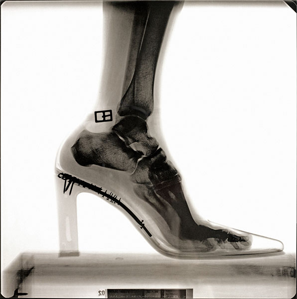 Photograph Antti Viitala X Ray on One Eyeland