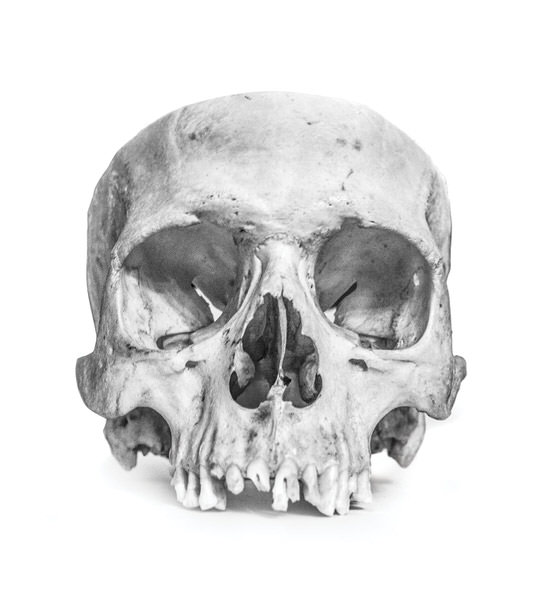 Photograph David Krovblit Skull Study on One Eyeland