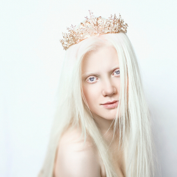 Photograph Tatsiana Tsyhanova Albino on One Eyeland