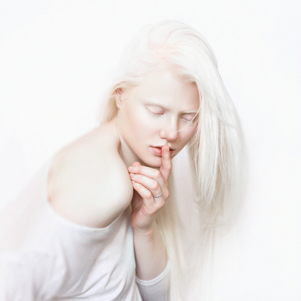 Photograph Tatsiana Tsyhanova Albino on One Eyeland