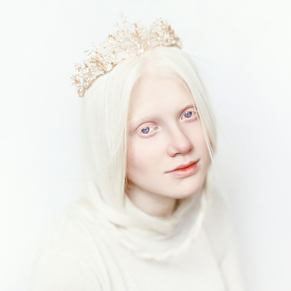 Photograph Tatsiana Tsyhanova Albino on One Eyeland