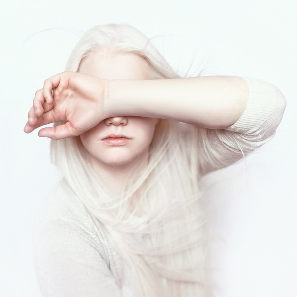 Photograph Tatsiana Tsyhanova Albino on One Eyeland