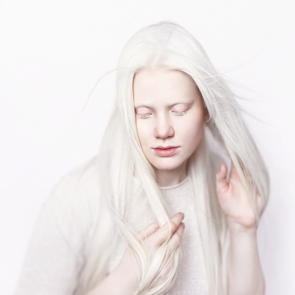 Photographer Tatsiana Tsyhanova Albino One Eyeland 