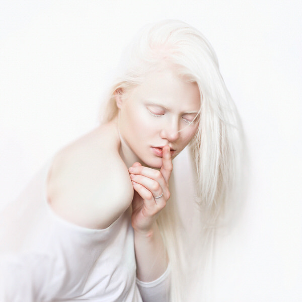Photograph Tatsiana Tsyhanova Albino on One Eyeland