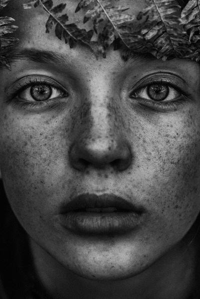 Photograph Magdalena Halas Freckled on One Eyeland