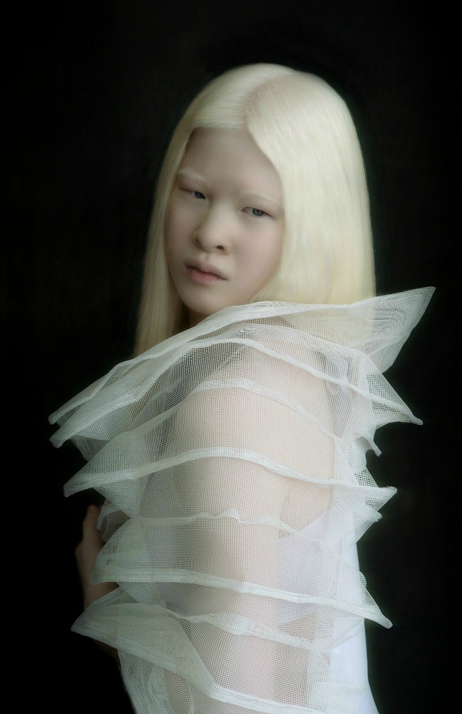 Photograph Reiny Bourgonje Albino Girl From China on One Eyeland