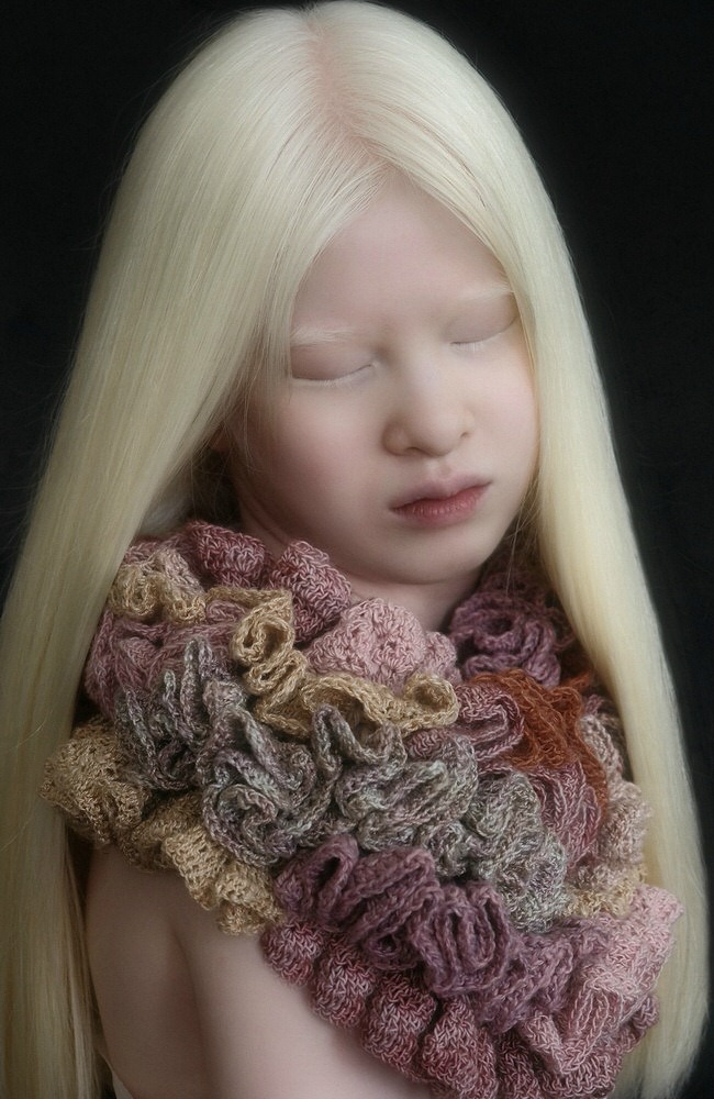Photograph Reiny Bourgonje Albinogirl From China on One Eyeland