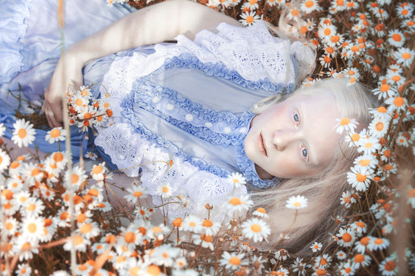 Photograph Michaela Durisova Dreaming Daisies A Field on One Eyeland