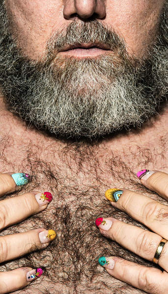 Photograph Kremer Johnson Seth Has Nails on One Eyeland