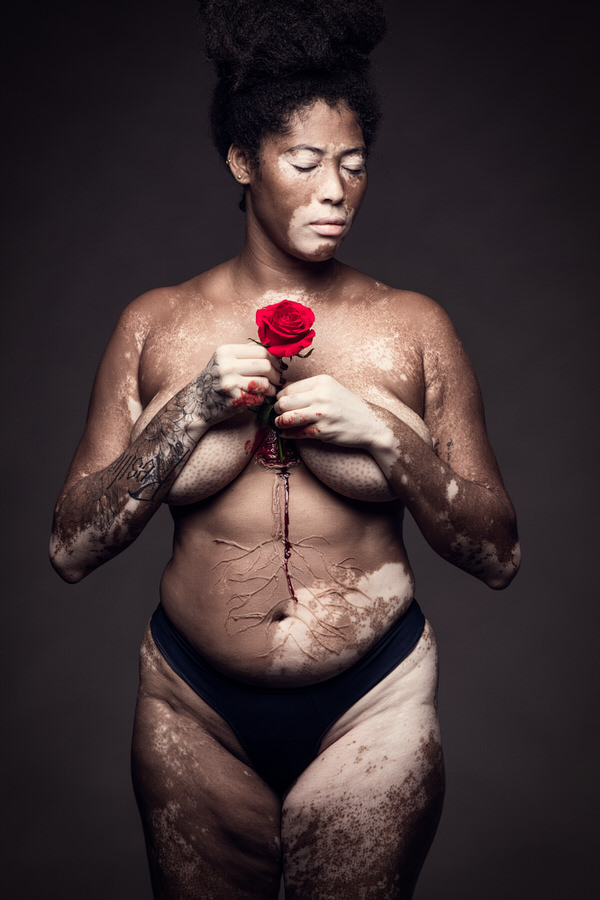 Photograph Dodo Villar Rooted Love on One Eyeland