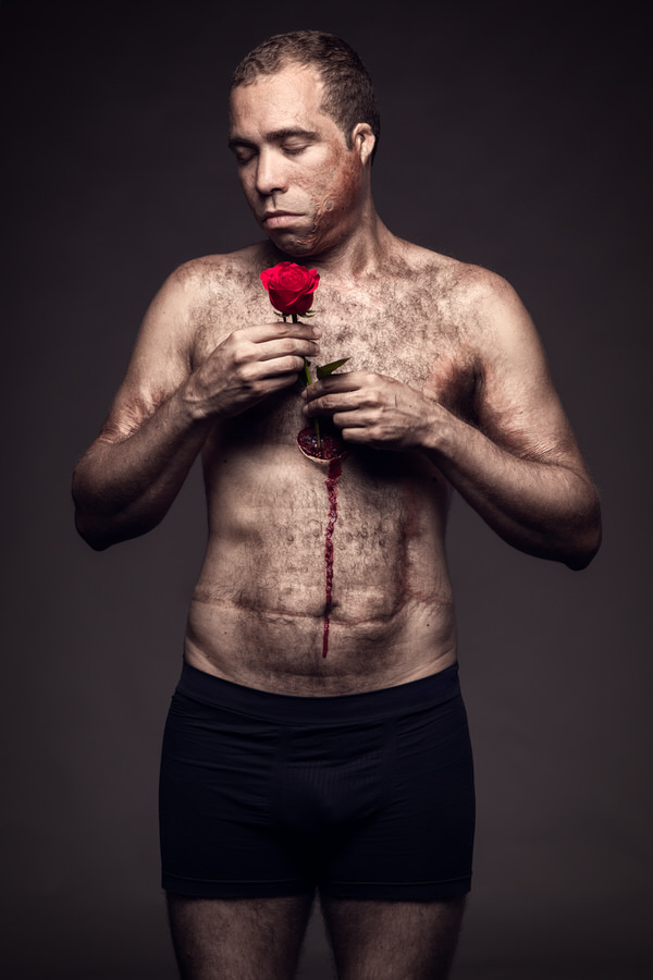 Photograph Dodo Villar Rooted Love Burned Man on One Eyeland