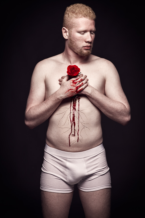 Photograph Dodo Villar Rooted Love Albino on One Eyeland