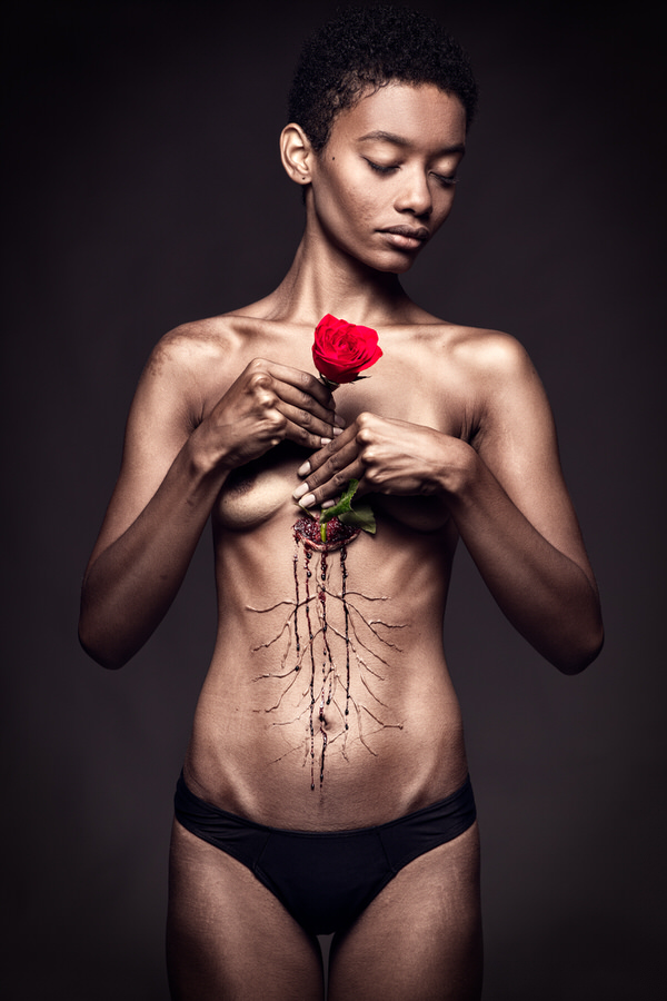 Photograph Dodo Villar Rooted Love Anorexic on One Eyeland