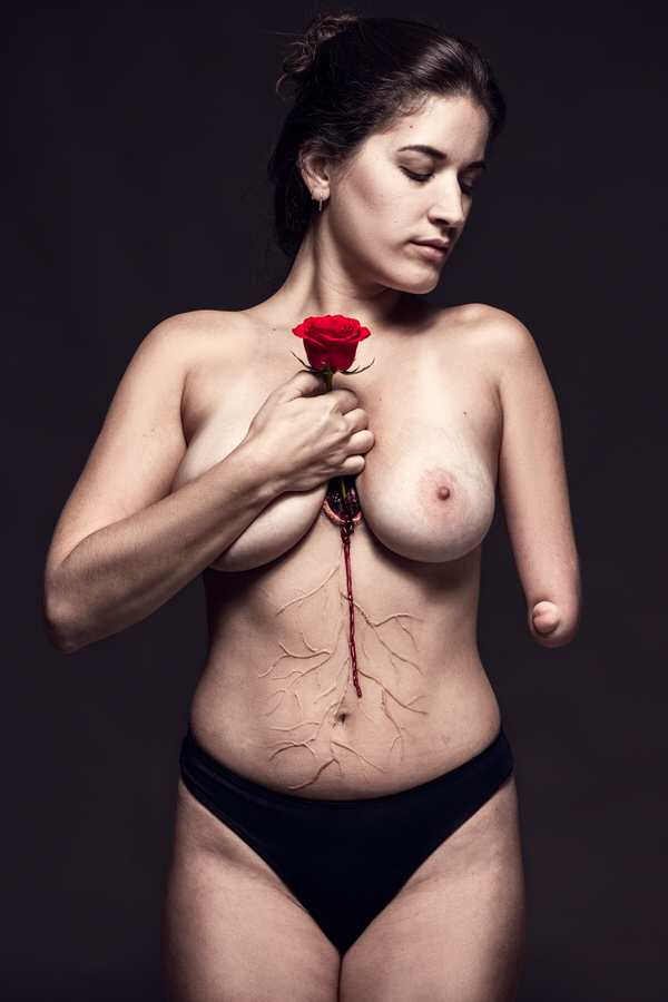Photograph Dodo Villar Rooted Love Amputed Arm on One Eyeland