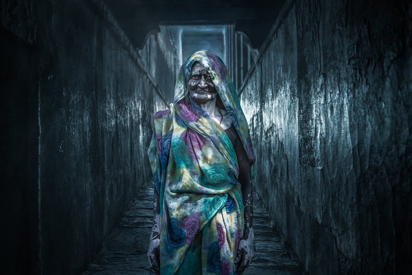 Photograph Cooltango Oonhateparuk Skin Diseases Lady on One Eyeland