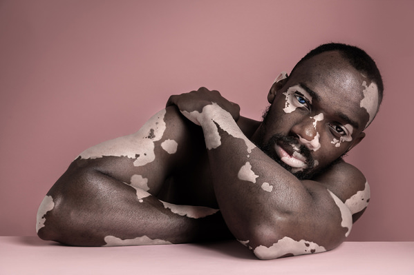 Photograph Lustre Photoproduction Inclusivity on One Eyeland