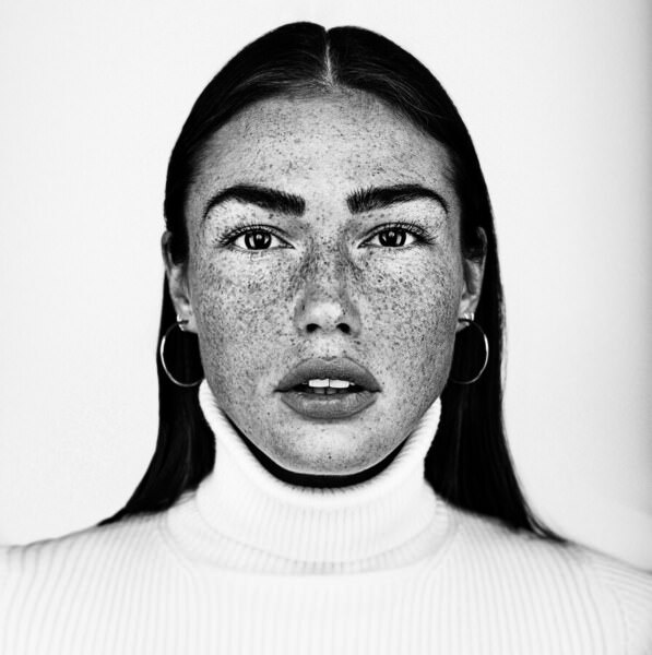 Photograph Martin Krystynek Freckles on One Eyeland