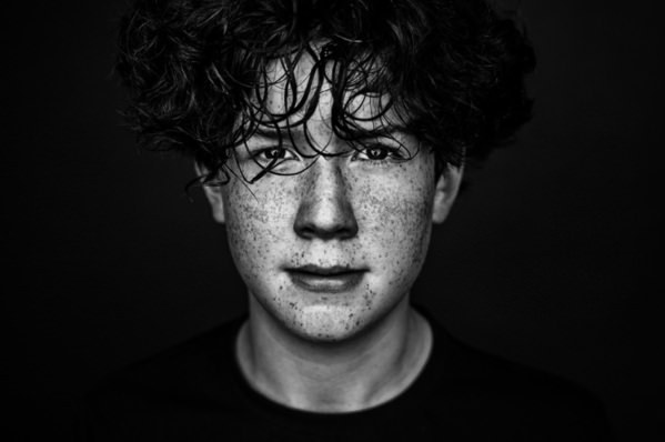Photograph Martin Krystynek Freckles on One Eyeland