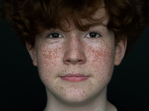 Photograph Martin Krystynek Freckles on One Eyeland