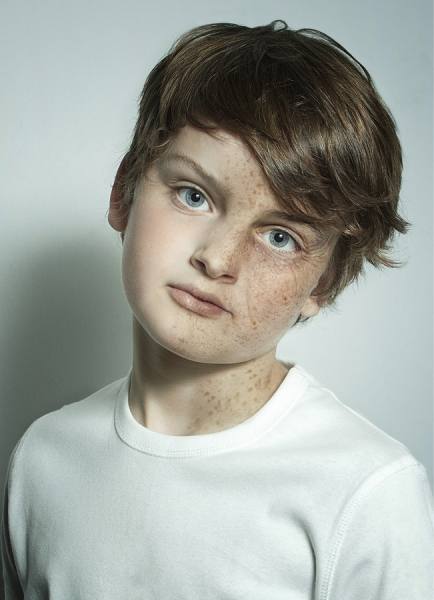 Photograph Lee Howell Skin Damage Awareness on One Eyeland