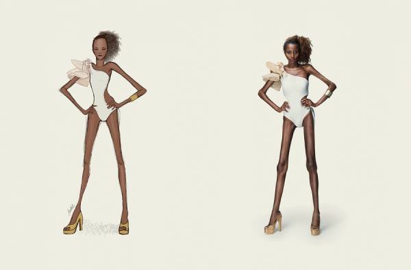 Photograph Diego Freire You Are Not A Sketch    Say No To Anorexia on One Eyeland
