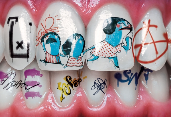 Photograph Pedro Dimitrow Teeth 1 on One Eyeland