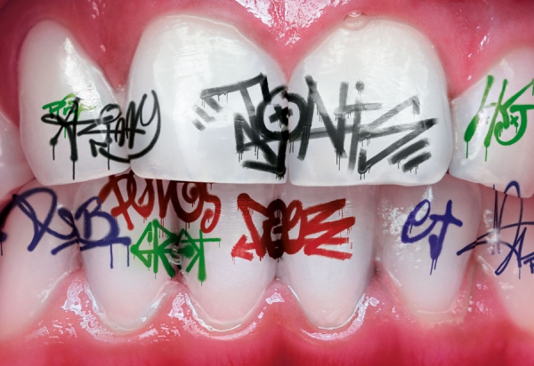 Photograph Pedro Dimitrow Teeth 2 on One Eyeland
