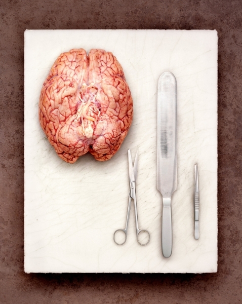 Photograph Dirk Fellenberg Pathology on One Eyeland