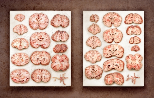 Photograph Dirk Fellenberg Pathology on One Eyeland