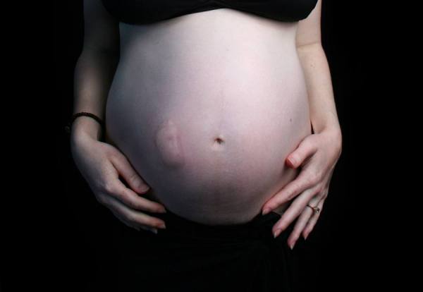 Photograph Ondrej Hruby First Step on One Eyeland