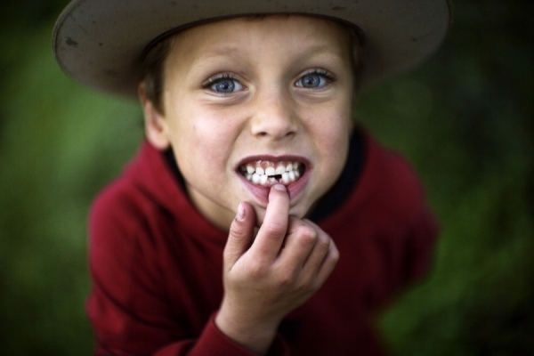 Photograph Jim Erickson Missing Tooth on One Eyeland