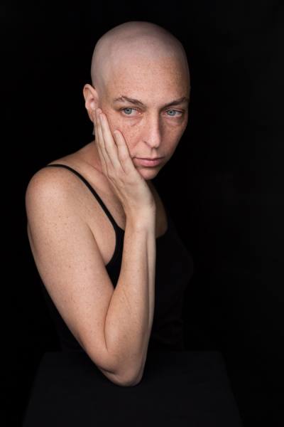 Photograph Robert Houser Facing Chemo on One Eyeland