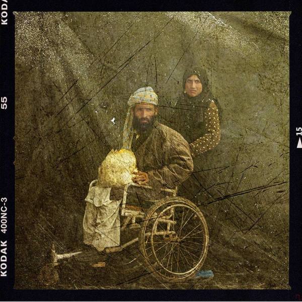 Photograph Majid Saeedi Landmine Victims on One Eyeland