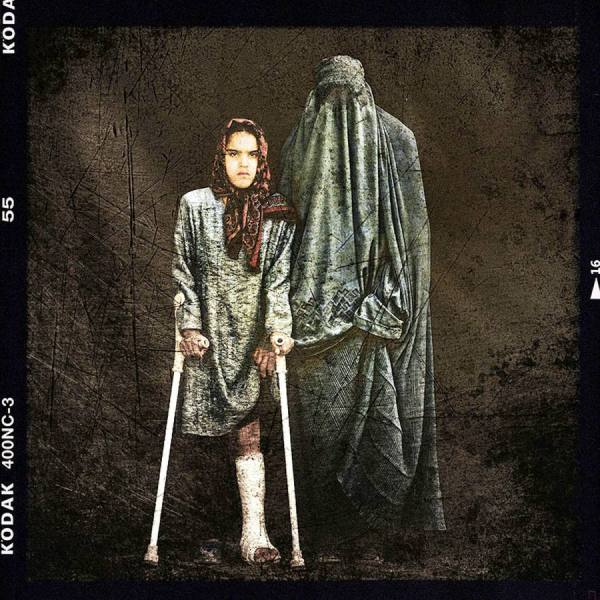 Photograph Majid Saeedi Landmine Victims on One Eyeland