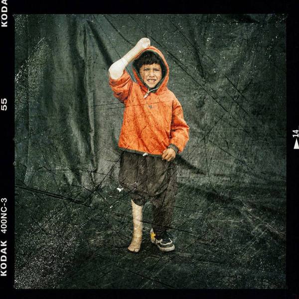 Photograph Majid Saeedi Landmine Victims on One Eyeland