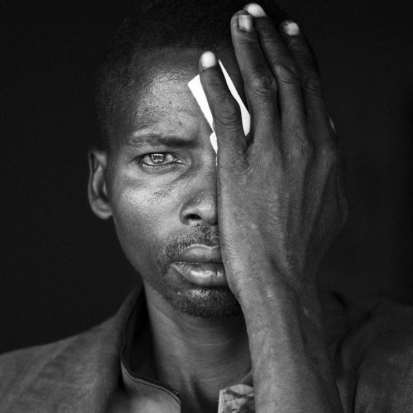 Photograph Sean Breithaupt Orbis Ireland Saving Sight In Ethiopia on One Eyeland