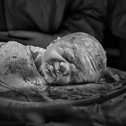 Gentle Caesarean Birth-Belle Verdiglione-silver-black_and_white-1574