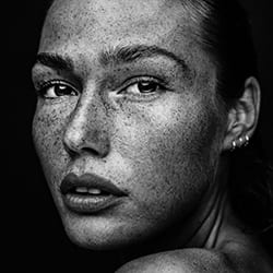 Freckles beauty 11-Martin Krystynek-finalist-black_and_white-12381