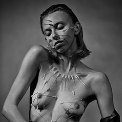 Phantom pain 1-Przemyslaw Gawlowski-bronze-black_and_white-15517